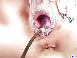 Una mujer mayor y delgada se enfrenta a un momento vergonzoso cuando un ginecólogo nota su flujo vaginal.